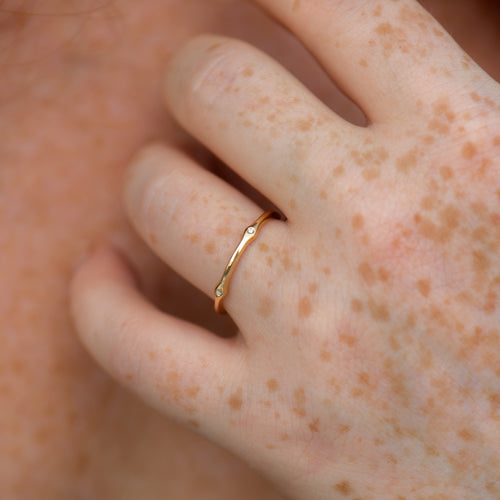 Golden-Eternity-Band-with-Brilliant-Diamond-Elements-freckles